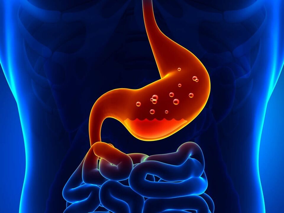 Gastritis ist eine entzündliche Erkrankung des Magens, die eine Ernährung erfordert